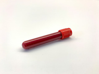 diagnosis kit with blood sample tube or swab used in coronavirus or covid-19 pandemic