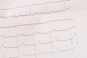 a piece of a electrocardiogram