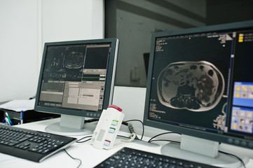 Medical theme. Diagnostic mri center in hospital, monitors of computer with human brain on it.