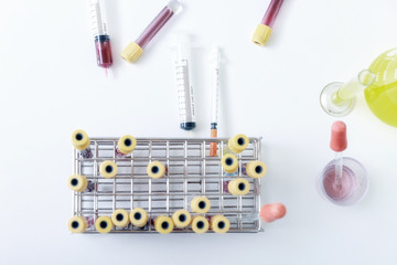 Top view of  blood samples in tubes and syringes on work table in a medical examination lab.