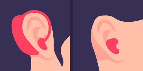 Close-up of the hearing aid device behind the human ear. In-the-canal and BTE - behind-the-ear hearing aid. A person with a hearing amplifier. Vector flat cartoon illustration. 