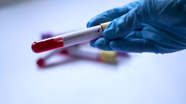 Coronavirus positive, COVID-19, Coronavirus Infected Blood