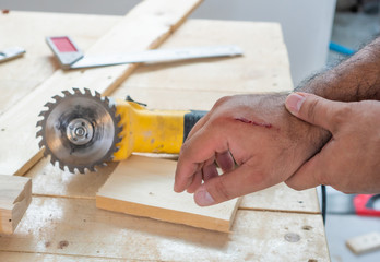 Fresh wound caused by saw blade ,fresh wound from accident while working with equipment.