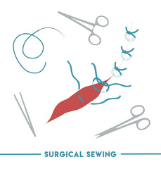 suture, stitch, surgical, medical, wound, sewing, treatment, anxiety, doctor, medical stuff, needle