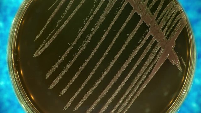 microbial growth in a petri dish time lapse