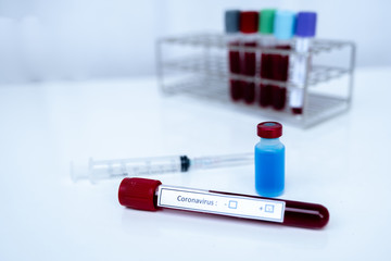 The picture of blood tube of coronavirus test and blue serum tube in white background