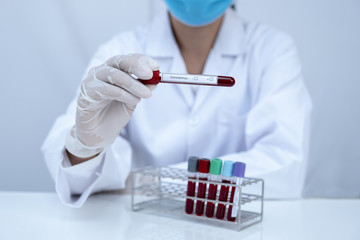 The picture of doctor's hand holding blood tube coronavirus test in white background