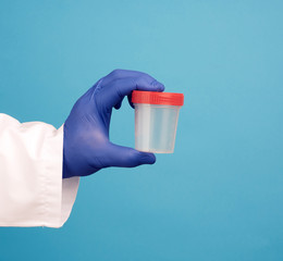 doctor in a white coat holds a empty plastic container for urine specimen