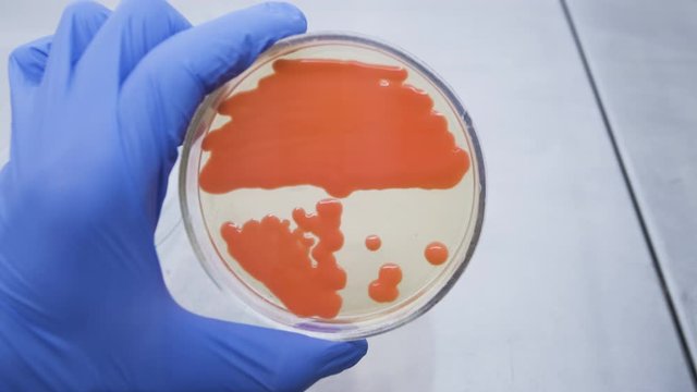 The scientist is considering a culture of baking yeast, which was developed in the laboratory.