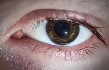 Close Up Of Eye