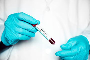 Nurse's hand taking a blood test of Covid-19