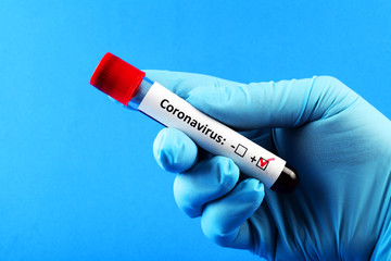 Fototapeta premium Coronavirus. Doctor's hand in a blue glove. Blood sample in vitro for analysis. Blue background.