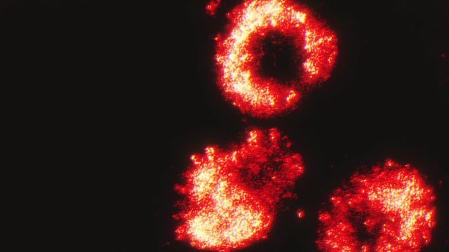 Covid 19 Coronavirus Outbreak Microscope View Background/ 4k animation of an abstract science microscope view background with Covid-19 coronavirus samples on grunge and glitch textures