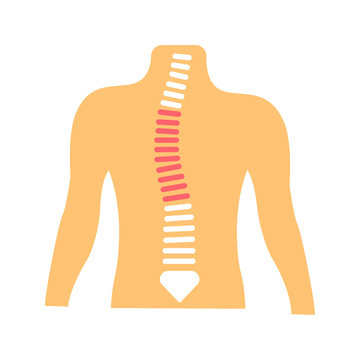 recommend clip art: Scoliosis flat color icon. Spinal deformity concept. Sign for web page, mobile app, button, logo. Vector isolated button.