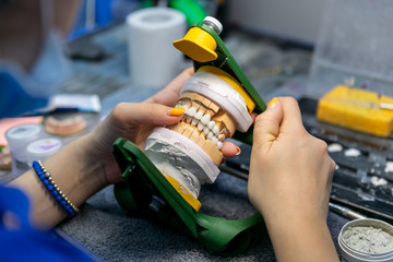 Denture layout. Technician corrects bite on a dental layout. Dental laboratory, implantation
