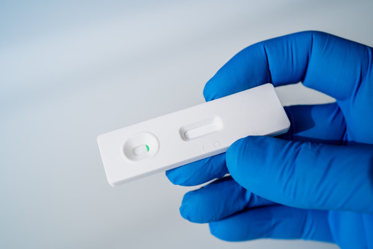 Test Kit For Viral Disease COVID-19 2019-nCoV. Lab Card Kit Test For Coronavirus SARS-CoV-2 Virus. Fast Test COVID-19.