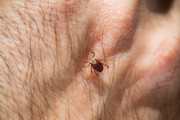 Mite tick. A tipical summer parasite in Europe. May cause several dangerouse infections and illness like erlechiosis, encephalitis, potomac fever and others
