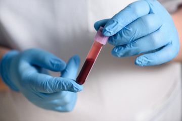 Doctor's hands holding a test tube with a blood sample for research new rapidly spreading...