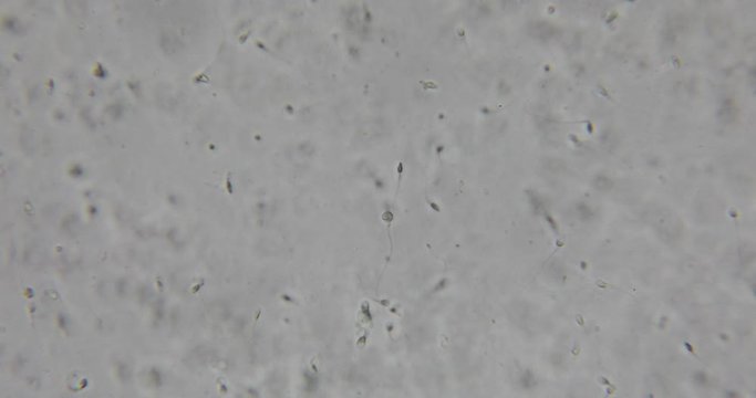 Human semen in phase contrast microscope