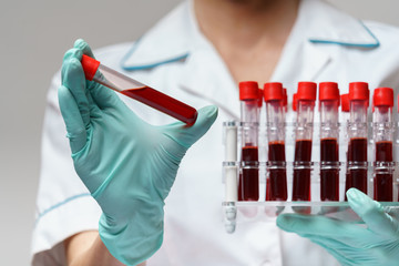 medical doctor nurse woman wearing protective mask and gloves - holding rack with virus blood tests