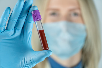 young blonde woman doctor holds a test tube with blood in her hand in blue gloves close-up. Concept...
