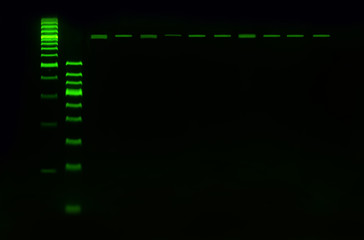 PCR band on agarose gel using  by molecular technique. Molecular analysis