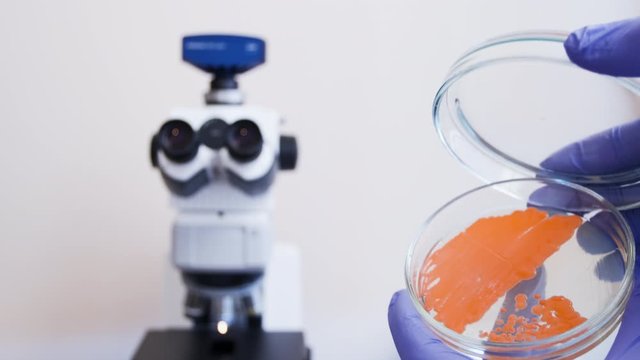 A scientist picks up and opens a Petri dish with orange colonies of bacteria against the background of a microscope.