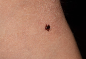 A small tick on a child’s leg. Dangerous insect, the carrier of many diseases.