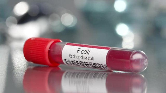 E.coli Escherichia coli antibodies vial in medical lab slowly rotating.