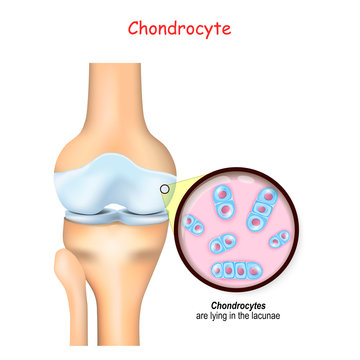 knee and close up of cells of a cartilage. chondrocyte