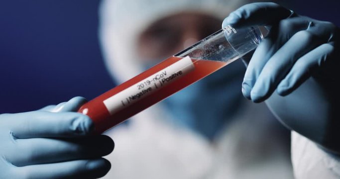 Close Up Of Full Equipped And Protected Medic In Medical Mask And Goggles Holding Glass Test Tube With Blood And Showing To Camera. Coronavirus Negative Testing. Doctor Shaking Head Like Answer No.