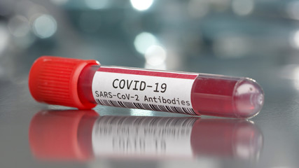 Covid-19 SARS-cov-2 antibodies vial in medical lab