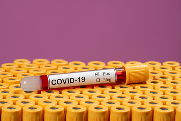 blood sample for COVID-19 on the tube tray