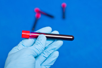 Hands in rubber gloves holding blood in test tube close up