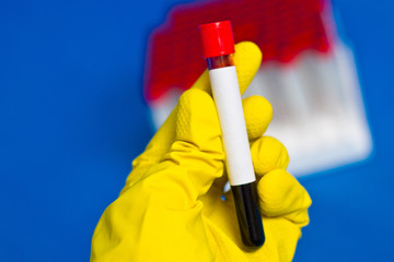 Нands in rubber gloves holding test tube with blood. Free place to write the result.