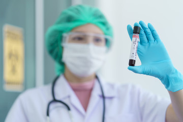 Doctor's hand holding a test tube with contaminated blood sample inside.