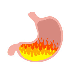 Digestive problems. Heartburn in stomach. Medical care. Indigestion in belly. Fire and internal organ of man. Symbol of Spicy food and pepper. Cartoon flat illustration