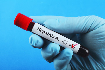 Obraz premium Vacuum test tube with blood in the doctor's hand. blood test for hepatitis A. Blue background.