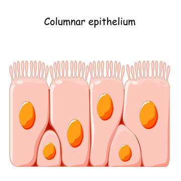 Ciliated columnar epithelium.