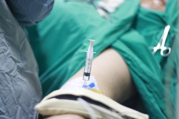 endoscopic surgery, endoscopic sinusitis surgeon