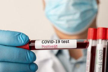 Photo of a doctor in laboratory with positive result on Covid-19 disease. Doctor infected by dangerous virus while working with ill patients