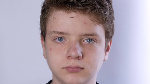 A cute teen boy with blond hair and blue eyes with problem skin and teenage acne is looking at the camera on a white background. Dermatological problems in a teenager. Young guy in a transitional age.