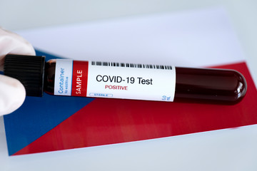 Fototapeta premium Testing for presence of coronavirus in Czech Republic. Tube containing a blood sample that has tested positive for COVID-19. Czech flag in the background.