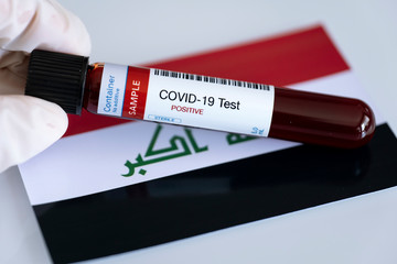 Testing for presence of coronavirus in Iraq. Tube containing a blood sample that has tested...