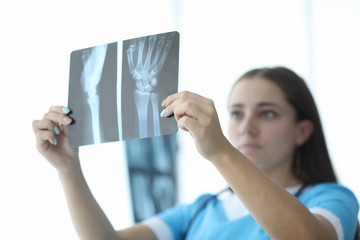 Close-up of female hands holding skiagram. Serious surgeon looking attentively on wrist x-ray and making diagnosis. Traumatology and health care concept