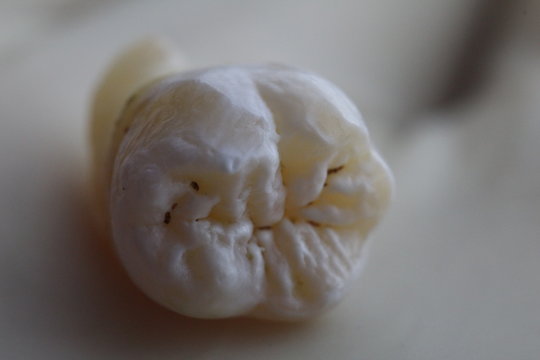 Anatom&iacute;a oclusal de la muela del juicio
