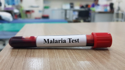 Malaria test and laboratory sample of blood testing for diagnosis Malaria or Plasmodium parasite...