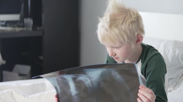 A blond boy is studying a picture of his lungs after a coronavirus infection.