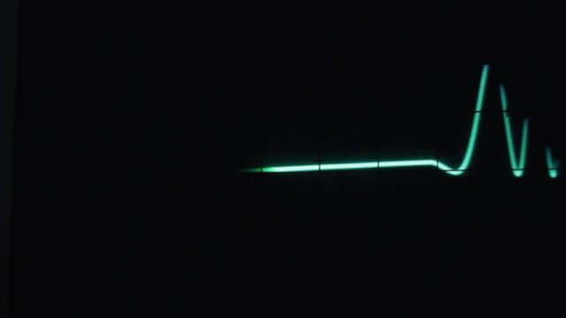 Sound Waveform (oscilloscope that measures voltage and intensity of the sound wave)