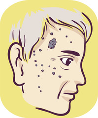Man Symptom Black Spots Illustration
